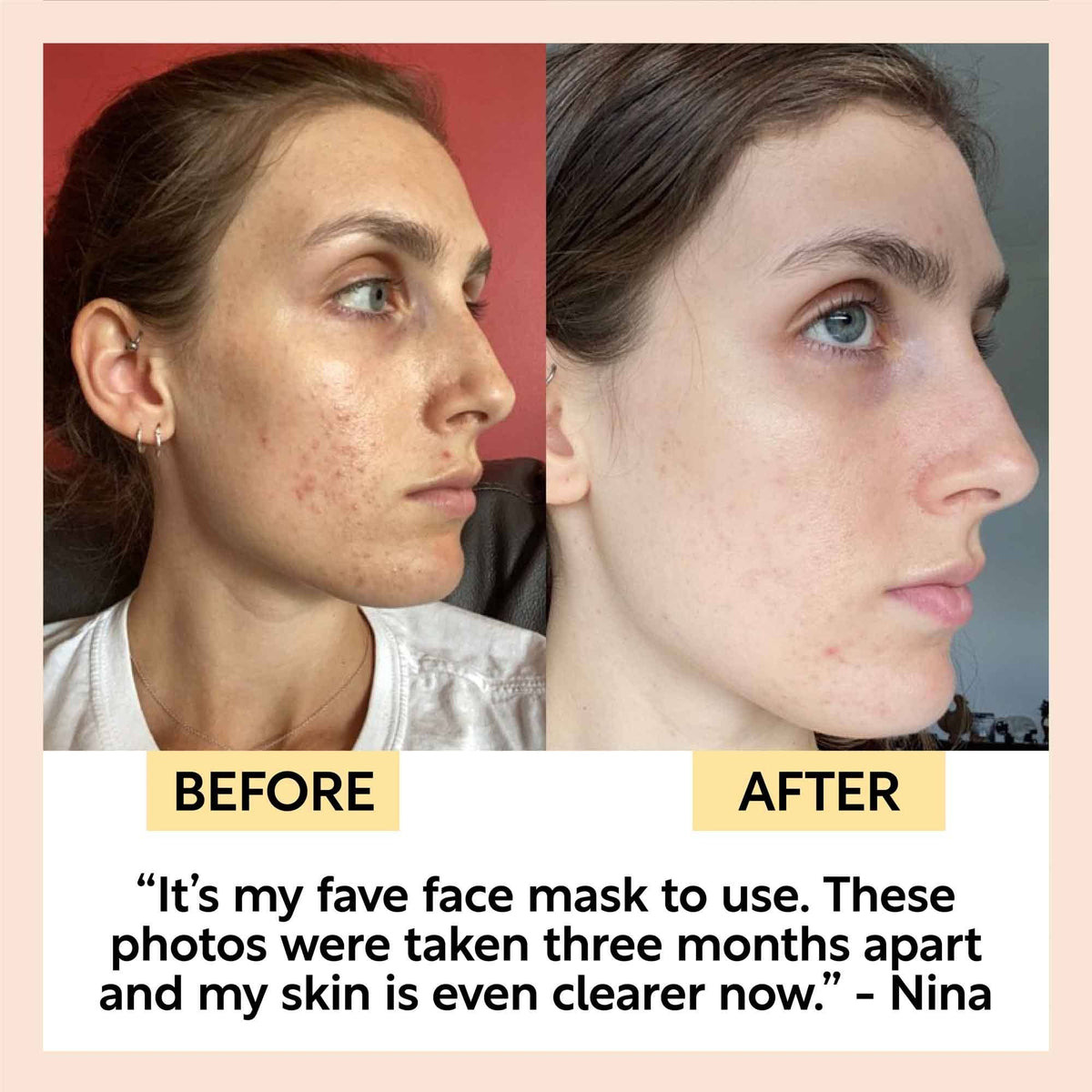 Detoxifying, Eco Face Mask