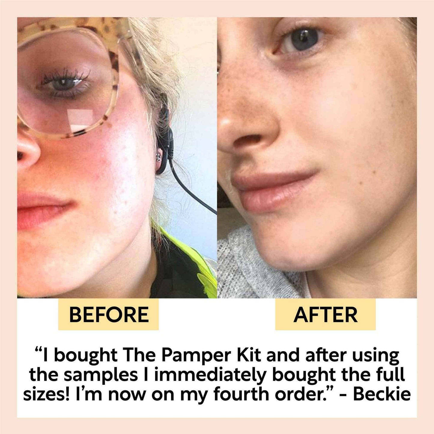 Pamper Kit - Eco Vegan Gift Set